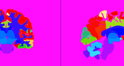 Kaksi piirroskuvaa aivoista, joiden eri alueet on merkattu eri värein.