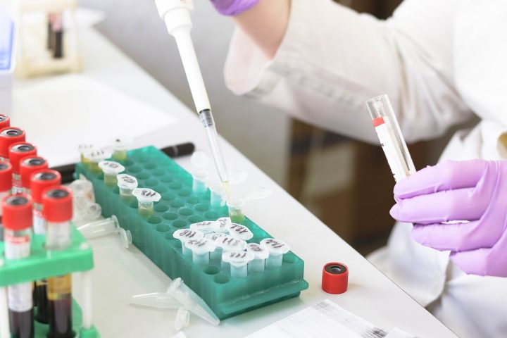 Ihminen pipetöimässä laboratoriossa, vain kädet näkyvät.