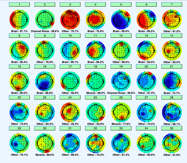 EEG brain activity recorded from a student during the Neuroimaging Methods course