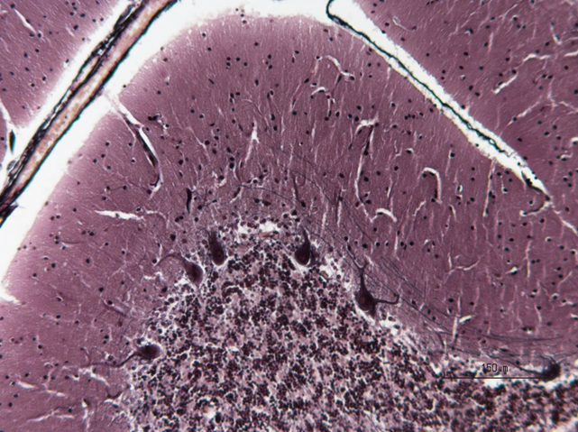A magnified microscopic image showing the different cells of the cerebellum taken during the Bioimaging and Microscopy course.